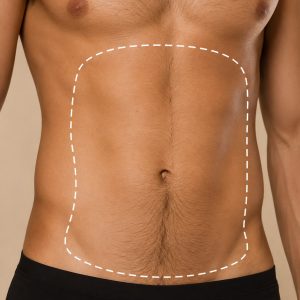 Depilación abdomen hombre (M)