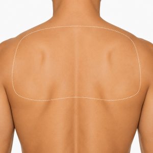 Depilación espalda superior hombre (L)