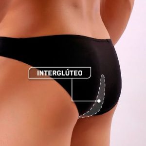 Depilación Linea interglútea Hombre (S)
