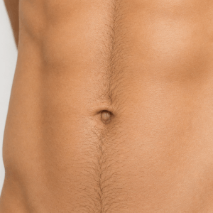 Depilación Línea Alba Hombre